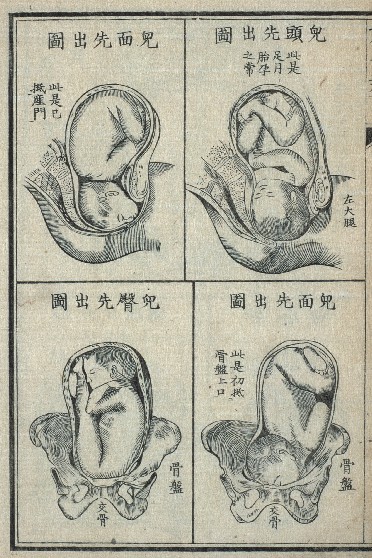 estampe japonaise médicale